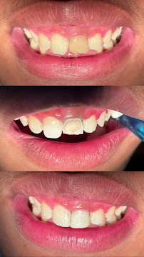 PRAKTEK DOKTER GIGI (DENTIST) drg. Desak G.R Adiasih S,kg