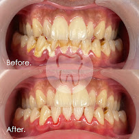 Bali Dentica