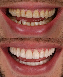 DOKTER GIGI / DENTIST KRISNA NUGRAHA