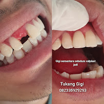 Tukang Gigi (Nusa Dua)