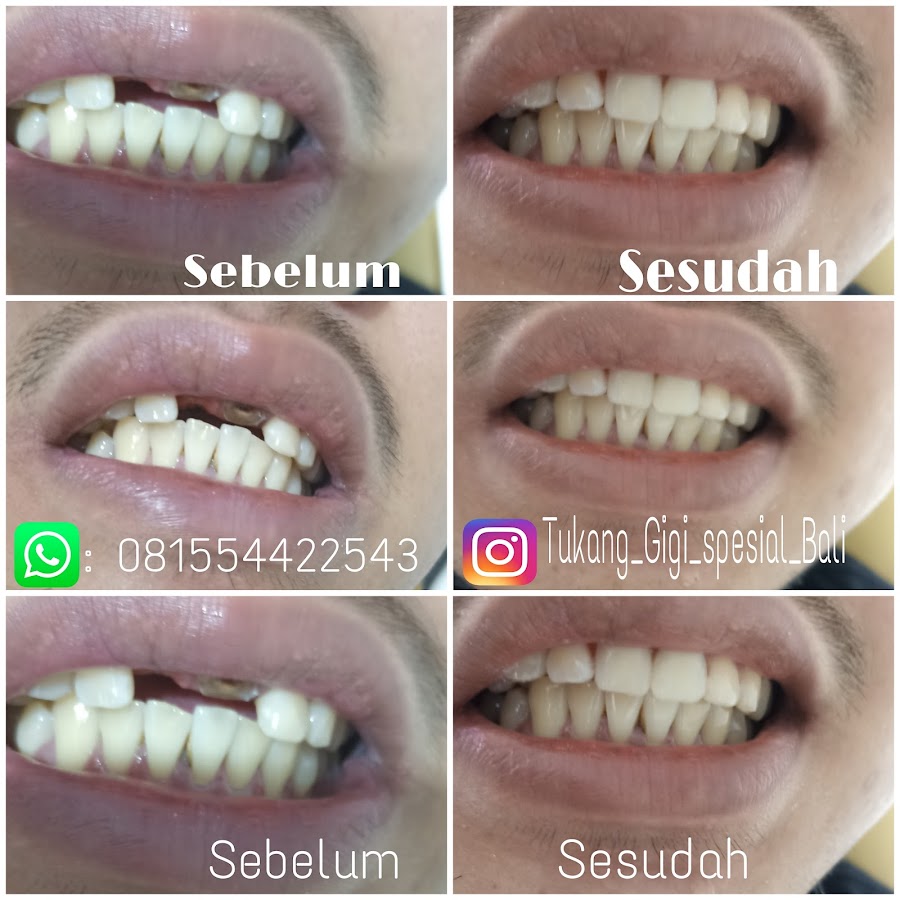 Tukang Gigi Spesial Bali dental clinic
