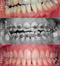 D’Light Dental Care dokter gigi di Denpasar Bali