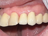 D’Light Dental Care dokter gigi di Denpasar Bali