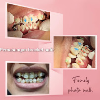 D’Light Dental Care dokter gigi di Denpasar Bali