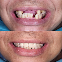 Glimlach Dokter Gigi & Implan Denpasar – drg. Ita Paramita