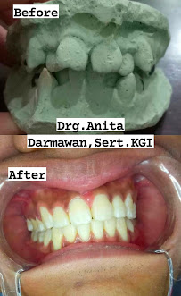 Drg Anita Darmawan, Sert. KGI