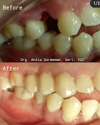 Drg Anita Darmawan, Sert. KGI