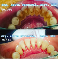 Drg Anita Darmawan, Sert. KGI