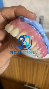 TUKANG GIGI PUSAT DENTAL BALI