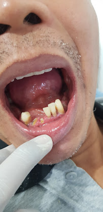 TUKANG GIGI PUSAT DENTAL BALI