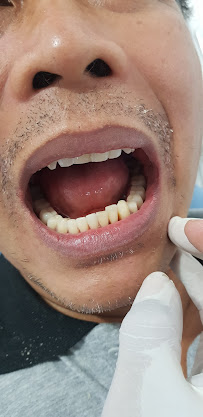 TUKANG GIGI PUSAT DENTAL BALI