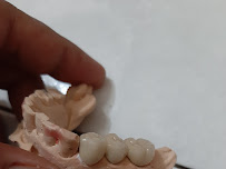 TUKANG GIGI BALI TOP DENTAL