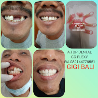 TUKANG GIGI BALI TOP DENTAL