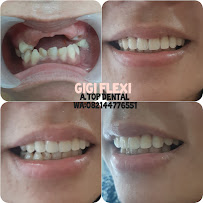 Tukang Gigi Bali Top Dental in Bali