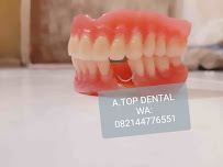 TUKANG GIGI BALI TOP DENTAL