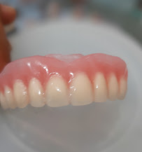 TUKANG GIGI BALI TOP DENTAL