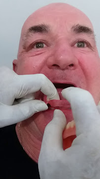 TUKANG GIGI BALI TOP DENTAL