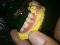TUKANG GIGI BALI TOP DENTAL