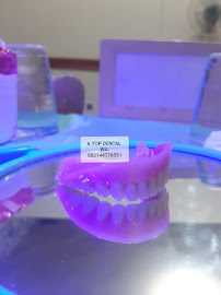 TUKANG GIGI BALI TOP DENTAL