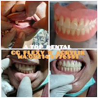 TUKANG GIGI BALI TOP DENTAL