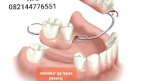 TUKANG GIGI BALI TOP DENTAL