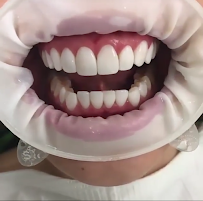 TUKANG GIGI BALI TOP DENTAL