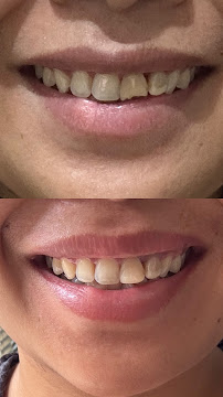 Kerobokan Dentis