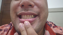 Kerobokan Dentis