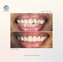 Kerobokan Dentis