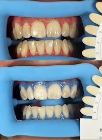 Praktek Dokter Gigi | Dentist | Teeth Whitening