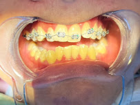 Praktek Dokter Gigi | Dentist | Teeth Whitening