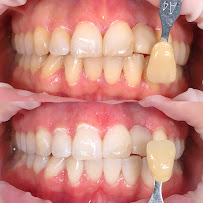 Kumara Dental Care Ubud (drg. D G Adikumara)