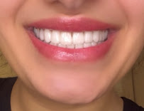 Ultradent - Dental Clinic Tbilisi