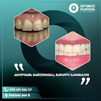 Optimus Dental Studio