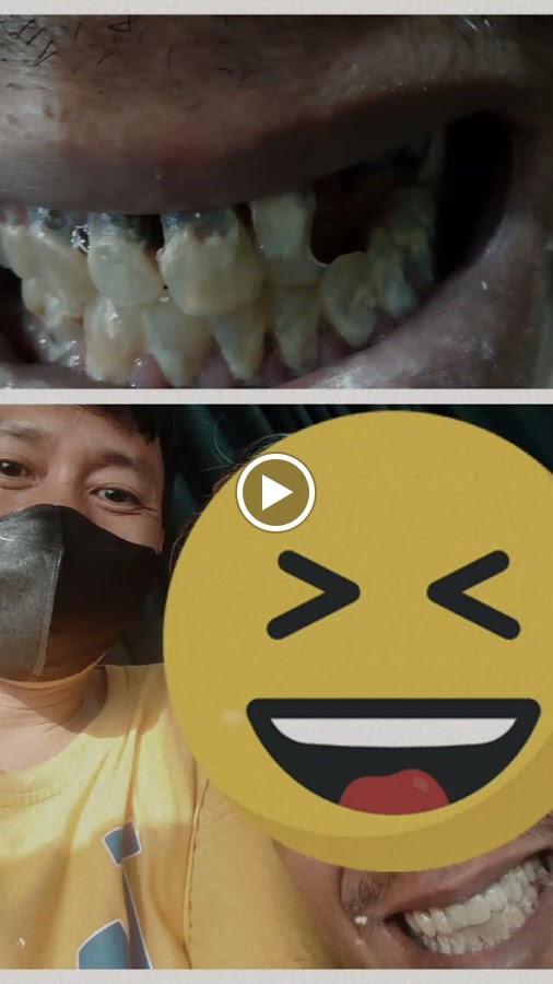 Tukang Gigi Sumber Barokah Dental dental clinic