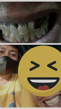 Tukang Gigi Sumber Barokah Dental in Bali