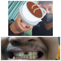 Tukang gigi sumber barokah dental