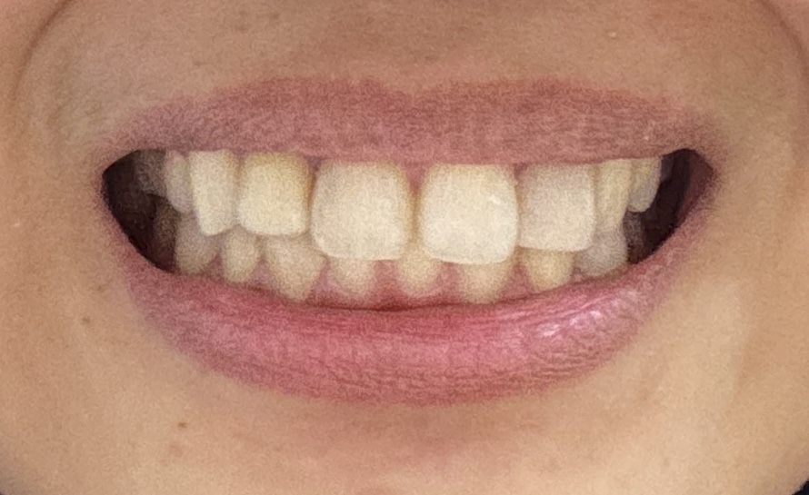 Mh Dental Care - dental clinic in Bali