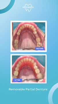 MH DENTAL CARE (drg. Made Hendra,S.KG)