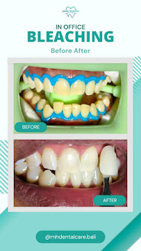 MH DENTAL CARE (drg. Made Hendra,S.KG)