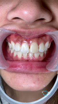 iMas Dental Care