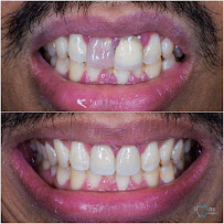iMas Dental Care