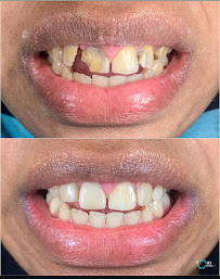 iMas Dental Care