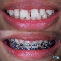 iMas Dental Care