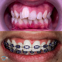 iMas Dental Care