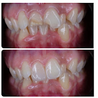 iMas Dental Care