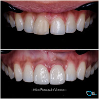 iMas Dental Care