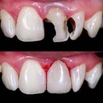 iMas Dental Care
