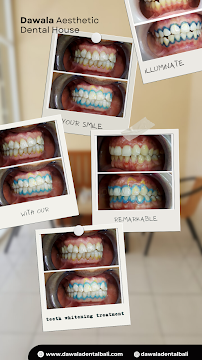 Dawala aesthetic dental house