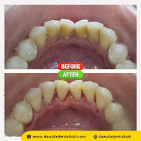 Dawala aesthetic dental house